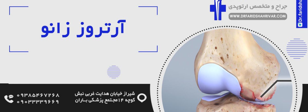 درمان جدید ارتروز در شیراز