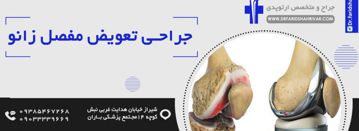جراحی تعویض مفصل زانو در شیراز