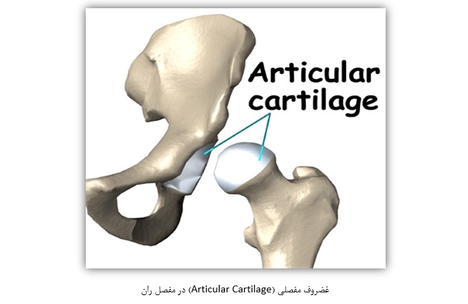 غضروف مفصلی (Articular Cartilage) در مفصل ران