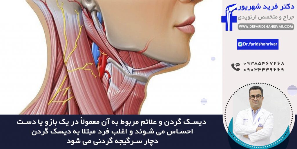 درمان دیسک گردن در شیراز