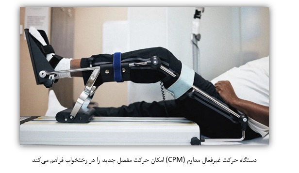 دستگاه حرکت غیرفعال مداوم(CPM)  امکان حرکت مفصل جدید 